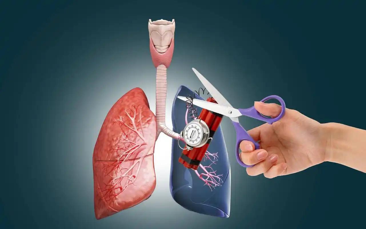 开云体育入口-女子因肺栓塞不幸走了!医生:天冷宁愿躺一天,也别干这5事!